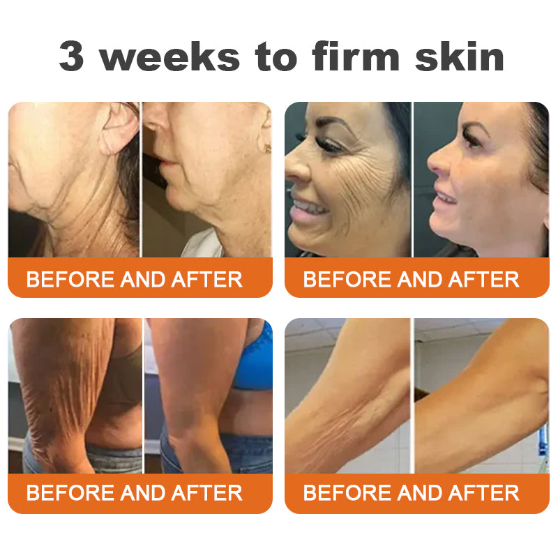 FirmHive |Botox Bee Venom Firming Serum Stick