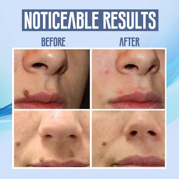 FlawlessFade Dark Spot Vanisher