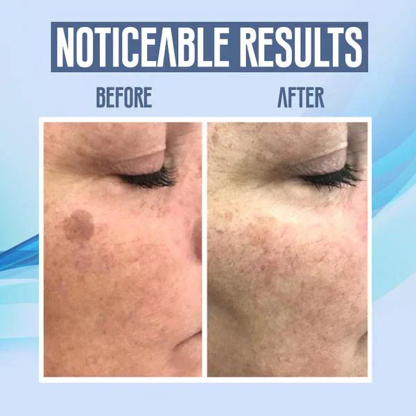 FlawlessFade Dark Spot Vanisher
