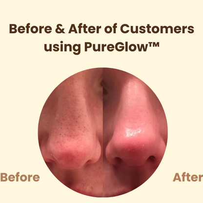 Last Day 50% OFF I PureGlow Black Tea Mask